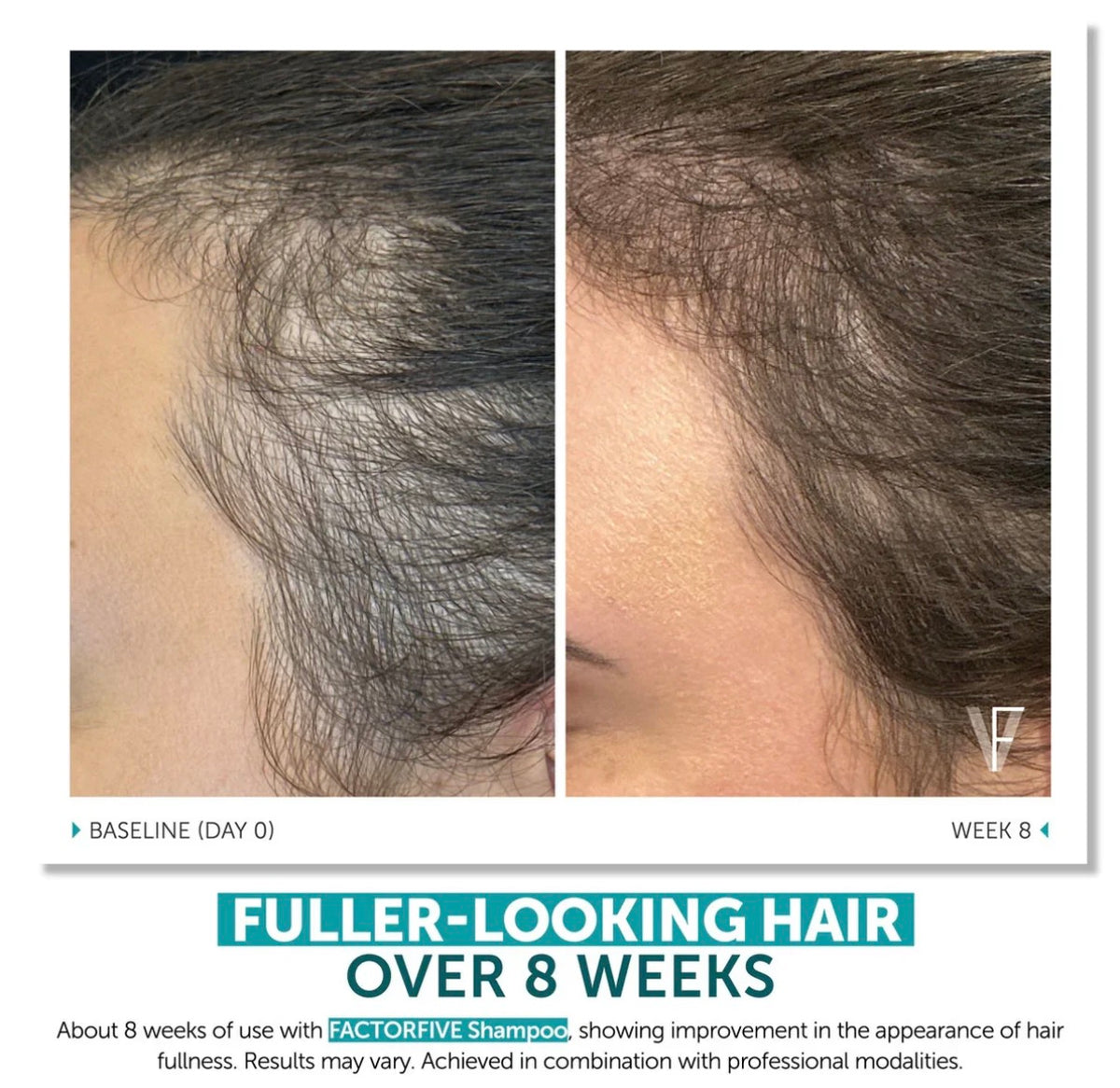 FactorFive Stemcell Shampoo