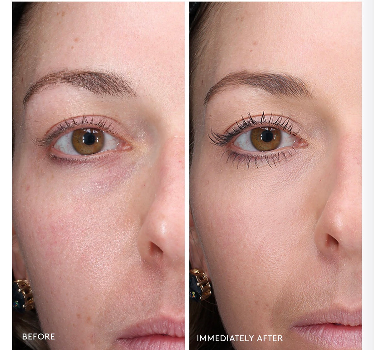 Total Eye® 3-In-1 Renewal Therapy SPF 35