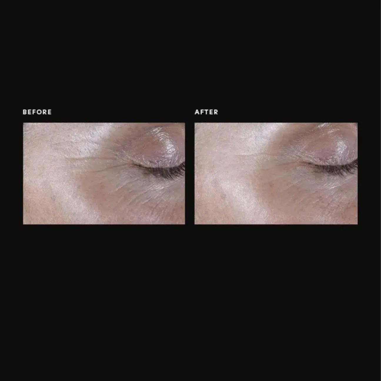 Exlinea Pro Serum