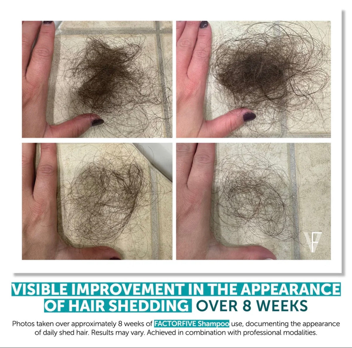 FactorFive Stemcell Shampoo