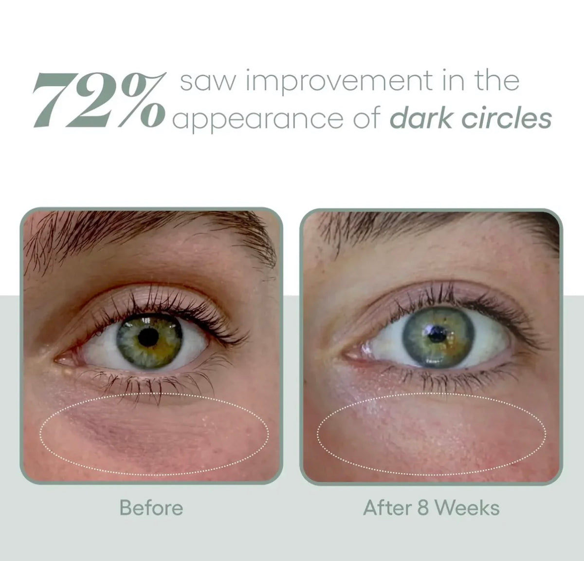 EYE Serum