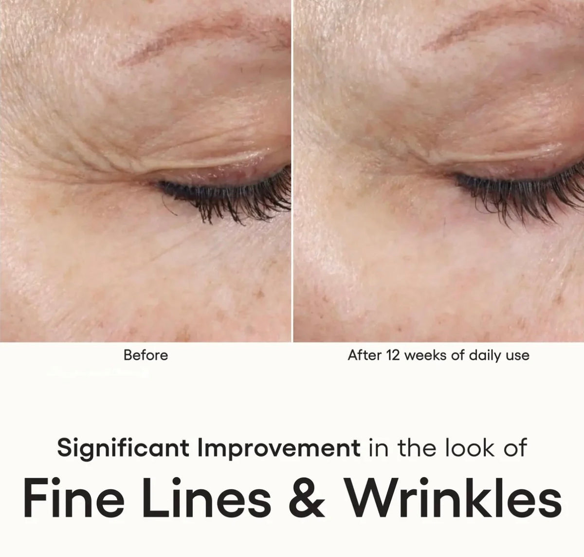 INTENSE Serum